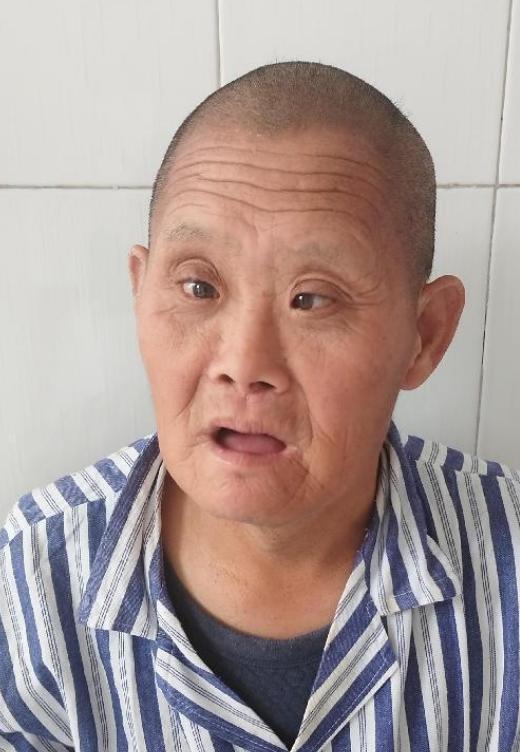 走失者照片 淄博寻亲：青年男子被救助，高1米5...