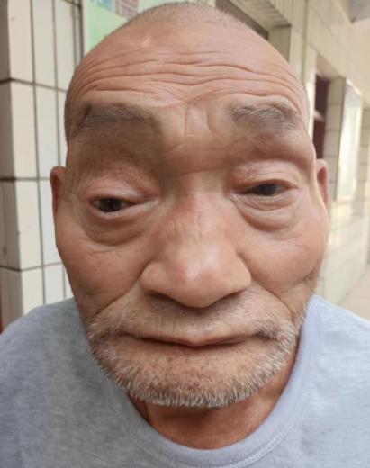 走失者照片 郑州寻亲：七旬老人被救助，自述叫王...