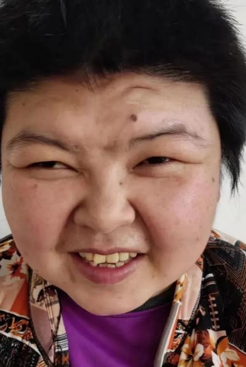 走失者照片 临沂寻亲：青年女子被救助，高1米5...