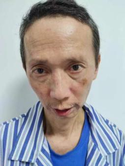 走失者照片 韶关南雄寻亲：五旬男子被救助，穿黑...
