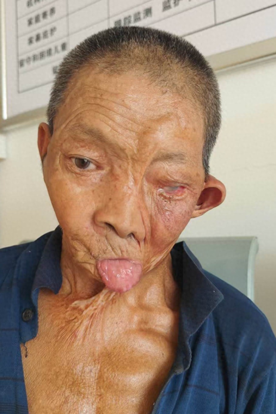 走失者照片 荆门京山寻亲：六旬老人被救助，自述...
