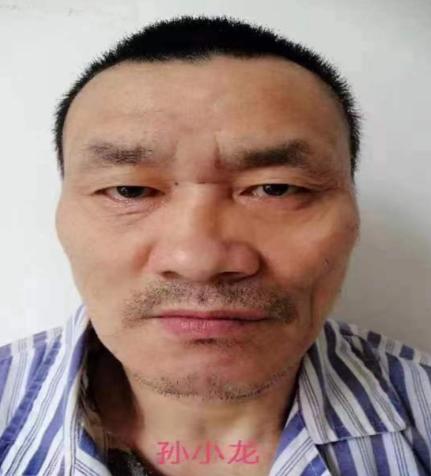 走失者照片 郑州寻亲：中年男子被救助，自述叫孙...