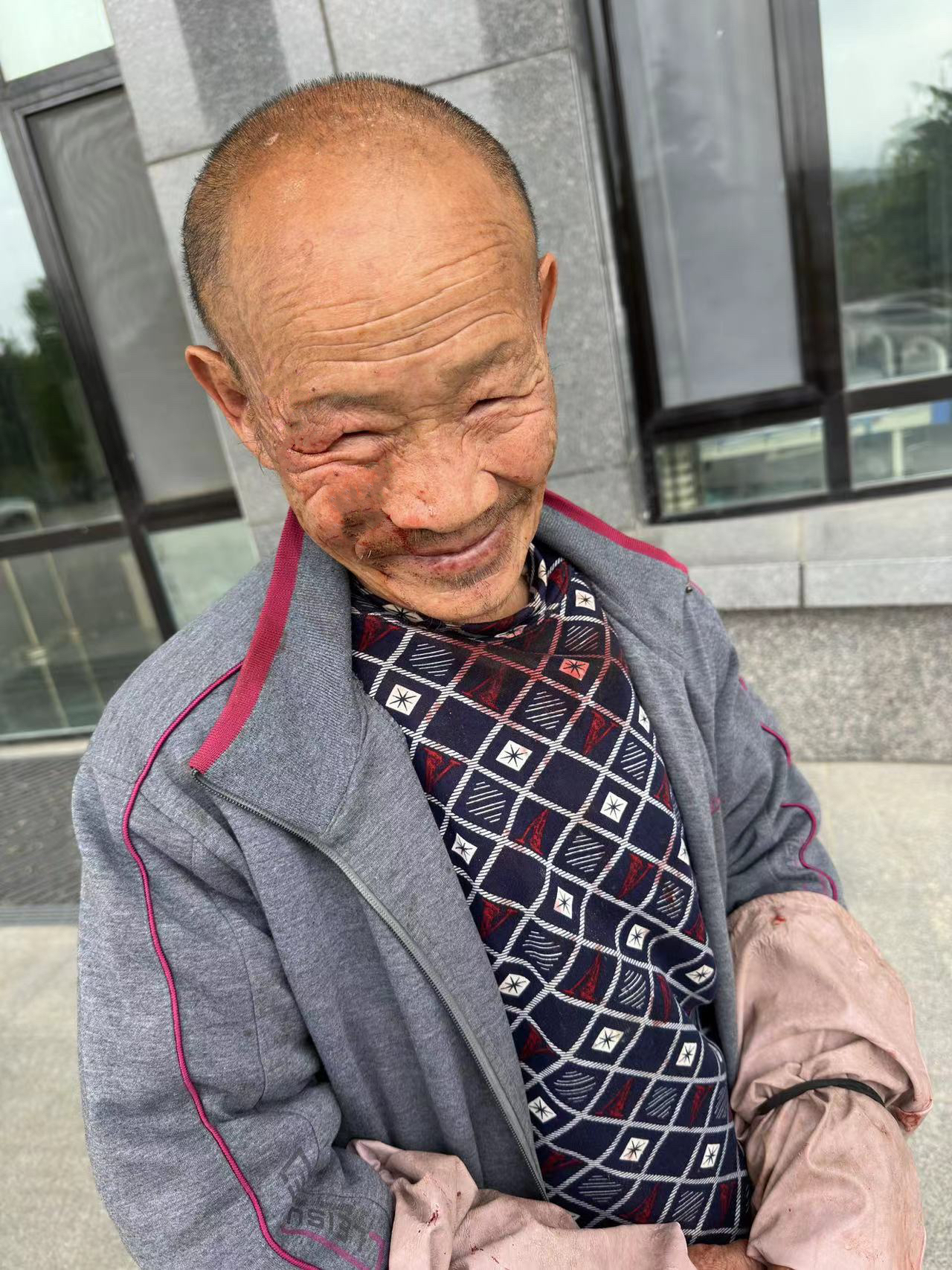 走失者照片 威海寻人！荣成市七旬老人走失，患智...