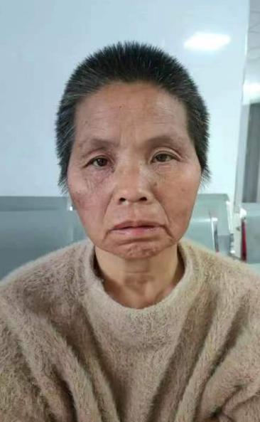 走失者照片 石家庄寻亲：六旬老太被救助，高约1...