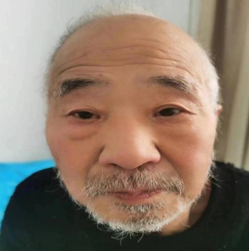 走失者照片 郑州寻亲：八旬老人被救助，自述叫王...