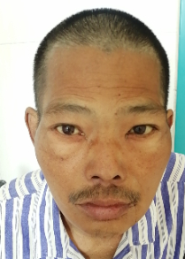 走失者照片 聊城市临清市寻亲：中年男子被救助，...