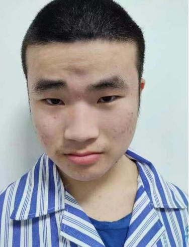 走失者照片 韶关寻亲：南雄市青年男子被救助多年...
