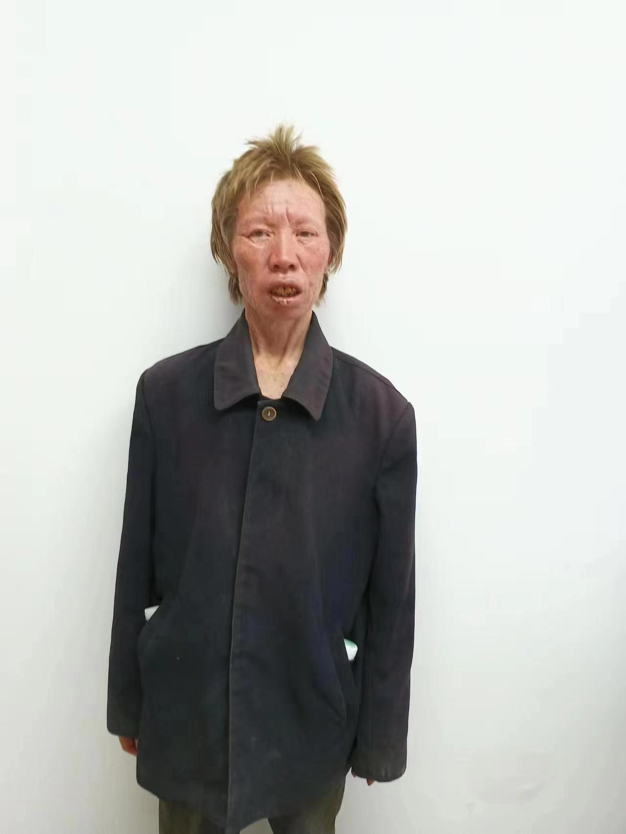 走失者照片 孝感市安陆市寻亲：六旬老太被救助，...