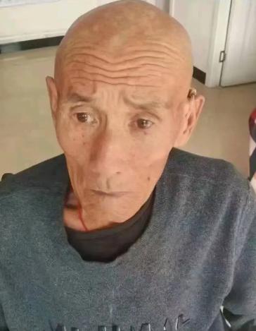 走失者照片 保定急寻：八旬老人走失，穿蓝色上衣...
