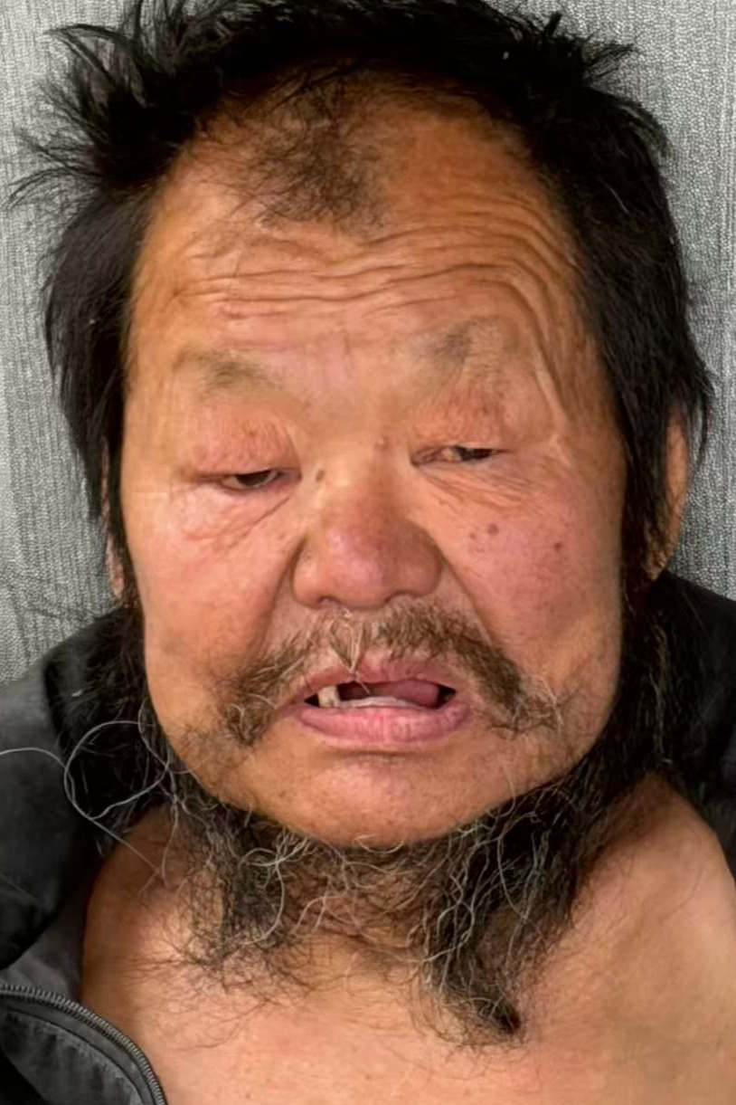 走失者照片 全国救助站