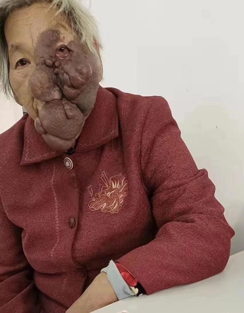 走失者照片 洛阳急寻：六旬老太失联，穿红色上衣...