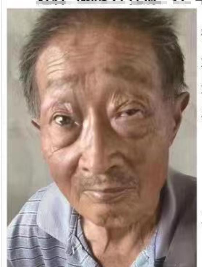 走失者照片 亳州八旬老人走失，穿灰色上衣，戴口...