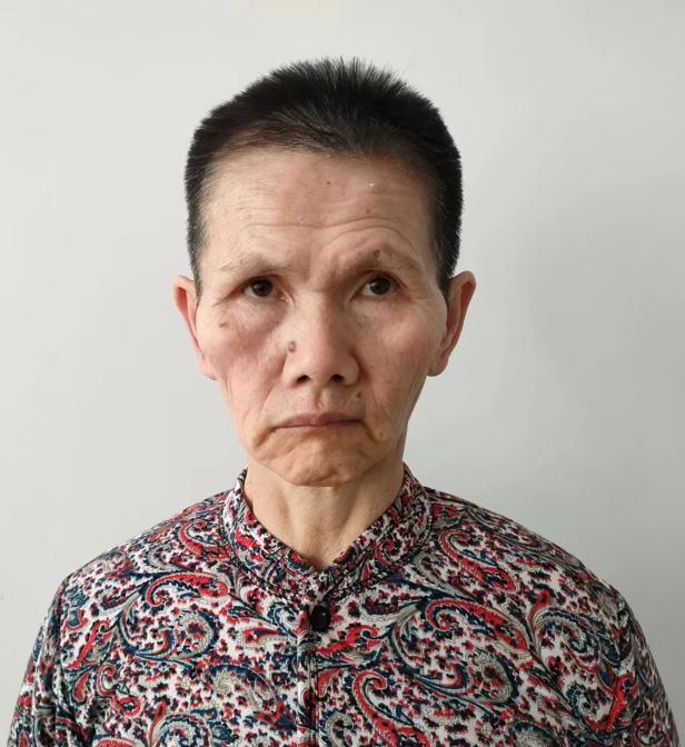 走失者照片 帮她回家：临沂五旬女子被救助多年，...