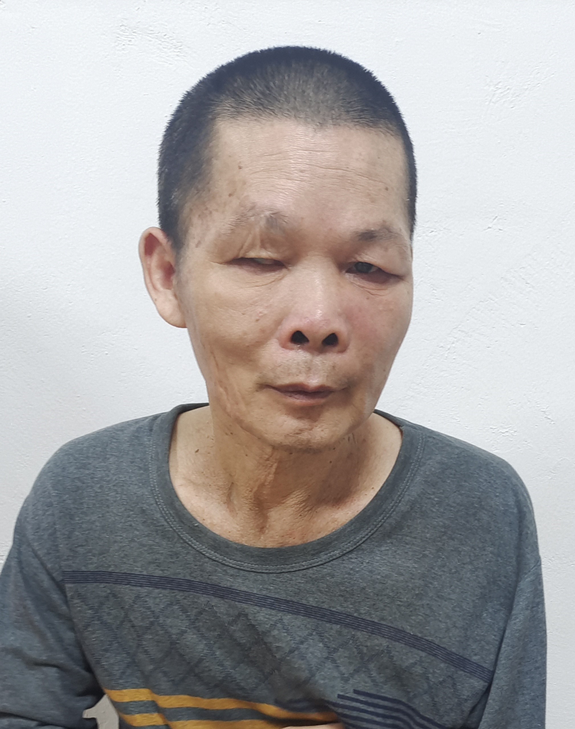 走失者照片 汕尾陆丰寻亲：五旬男子被救助，穿灰...