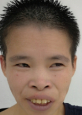 走失者照片 连云港寻亲：中年女子被救助，高1米...