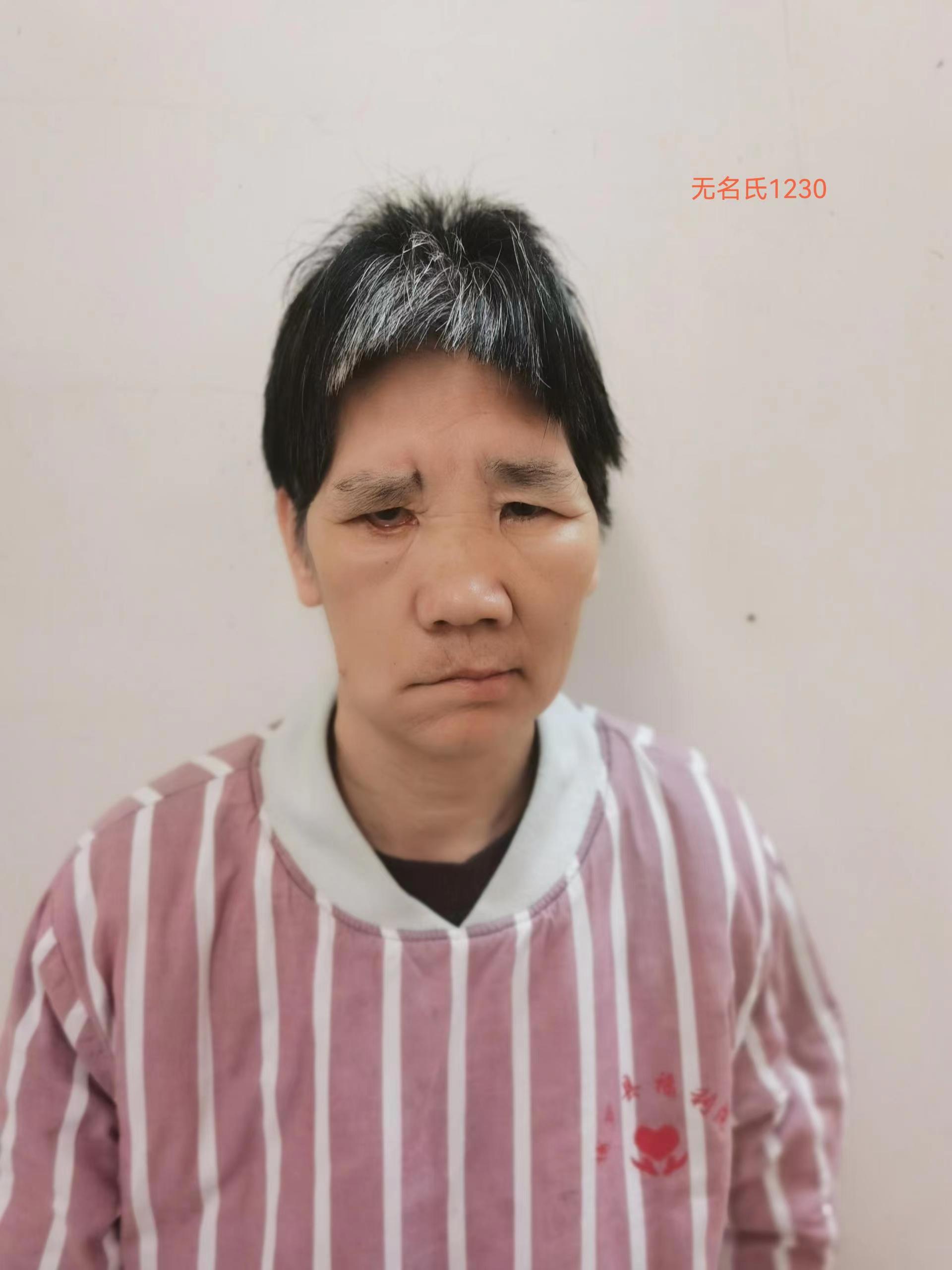 走失者照片 惠州寻亲：六旬老太被救助，衣着脏乱...