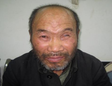 走失者照片 北京寻亲：六旬聋哑老人被救助，穿蓝...