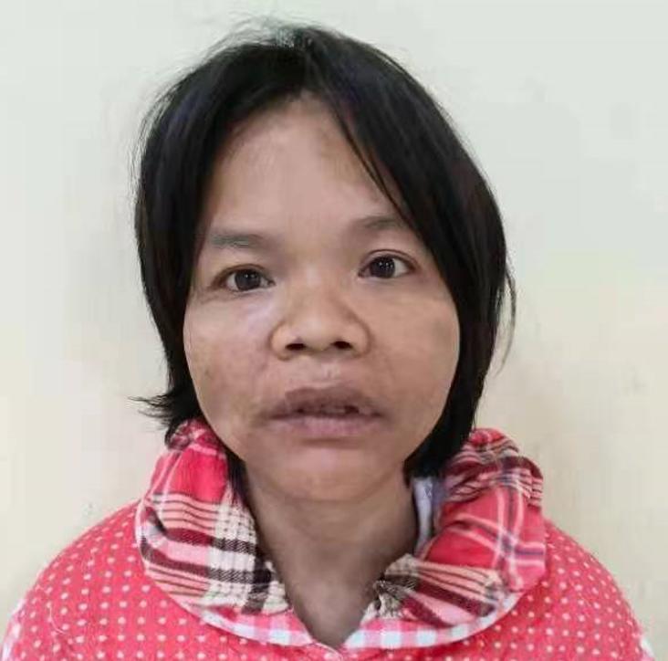走失者照片 驻马店寻亲：中年女子被救助，穿绿色...