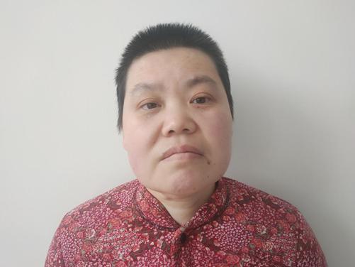 走失者照片 临沂寻亲：中年女子被救助多年，左侧...