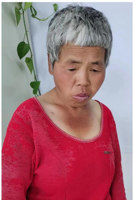 走失者照片 临沂寻亲：六旬老太被救助，花白头发...