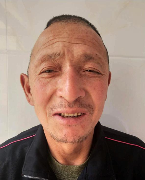 走失者照片 莱芜寻亲：五旬男子被救助，右侧头部...