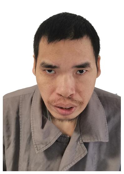 走失者照片 玉溪急寻：中年男子被救助多年，疑似...