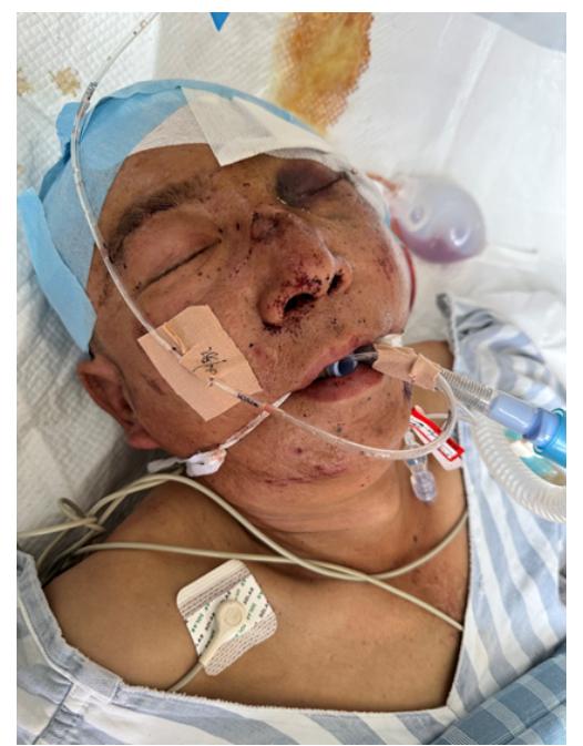 走失者照片 宁波寻亲：中年男子被救助，自述叫杨...