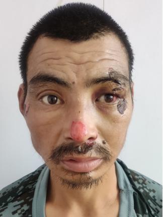 走失者照片 济南救助站：中年男子被救助多年，智...