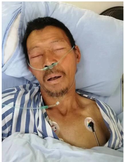 走失者照片 绵阳寻亲：五旬男子被救助，穿黑色带...
