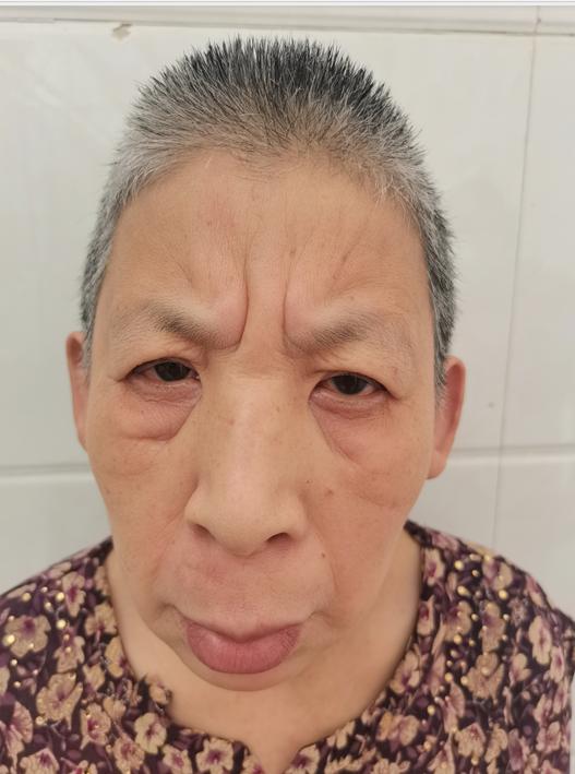 走失者照片 济南寻亲：六旬老太被救助，自述叫席...