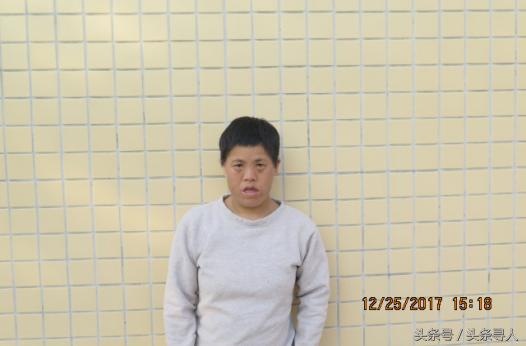 走失者照片 清远寻亲：中年女子被救助，右眼角与...