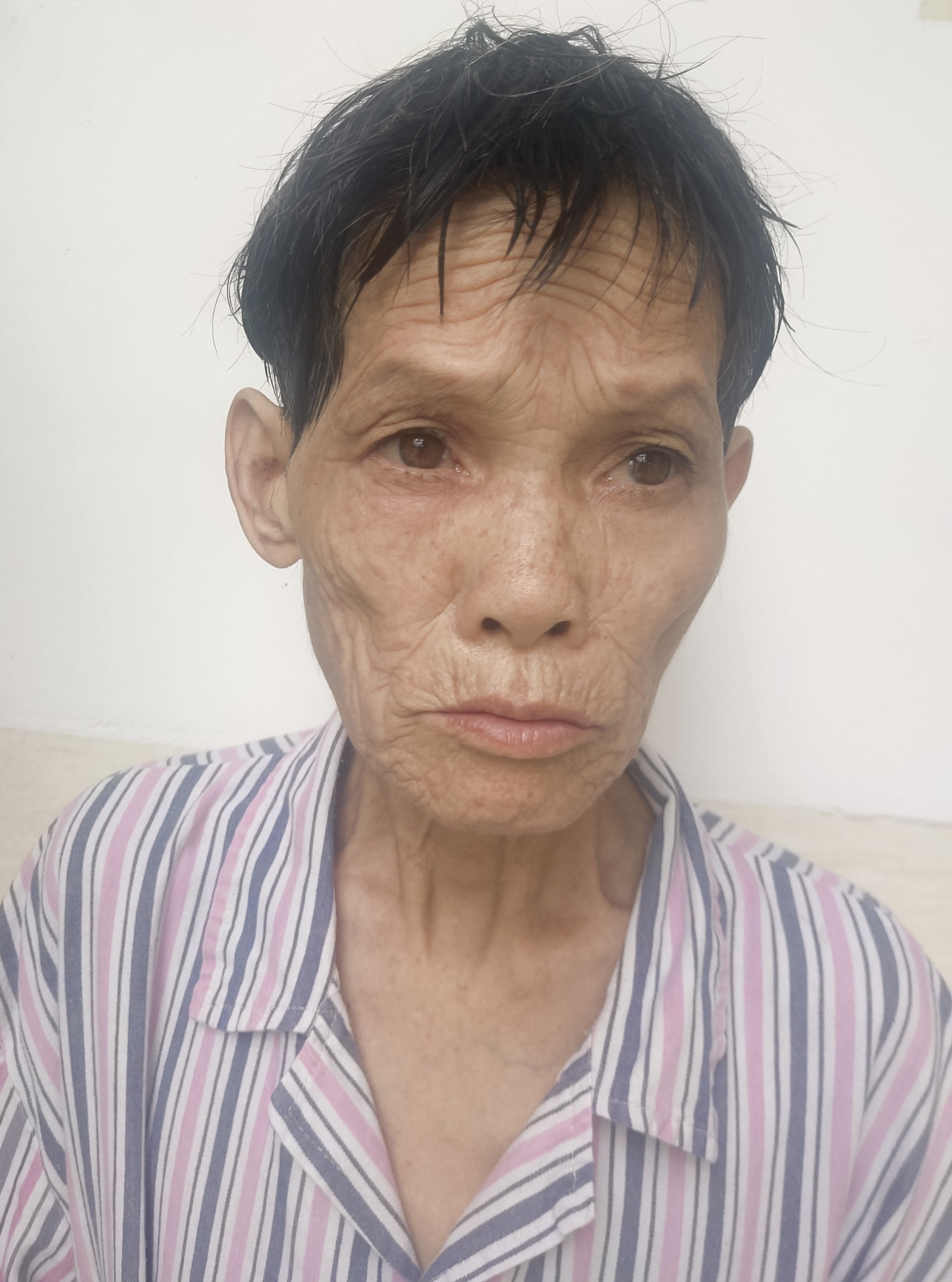 走失者照片 湛江市寻亲：七旬老太被救助，穿浅灰...