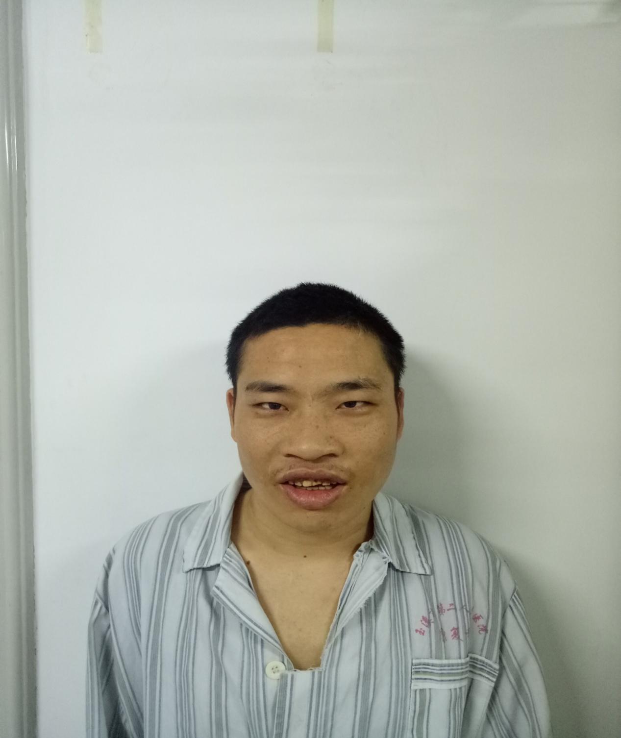 走失者照片 玉溪寻亲：中年男子被救助，自述叫罗...