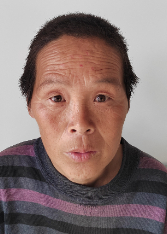 走失者照片 宿州寻亲：五旬男子被救助，穿条纹上...