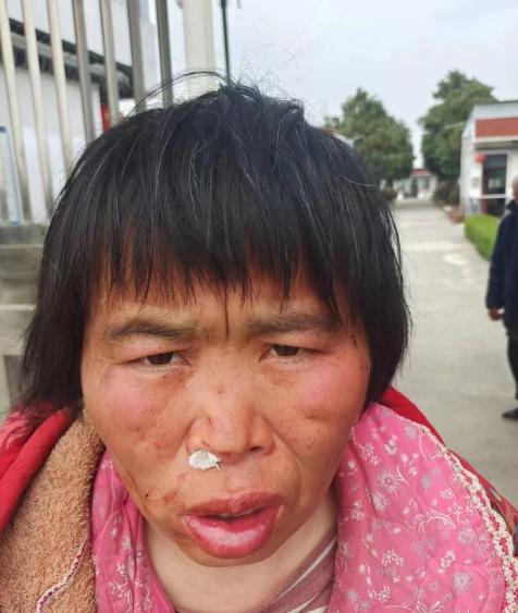 走失者照片 阜阳寻亲：中年女子被救助，穿红色花...