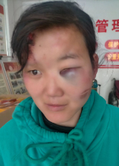 走失者照片 周口鹿邑县救助站：青年女子被救助，...