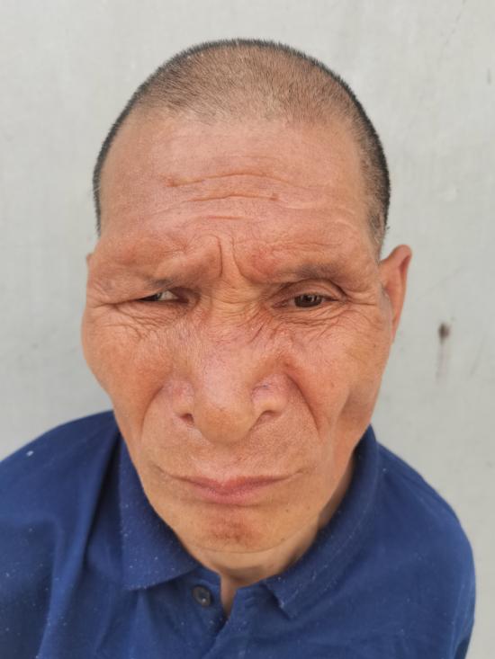 走失者照片 济南救助站：中年男子被救助，高约1...