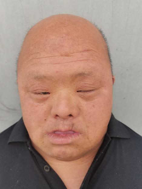 走失者照片 济南寻亲：中年男子被救助多年，自述...