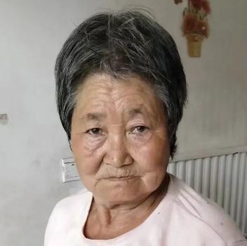 走失者照片 保定急寻：六旬老太走失，精神异常，...