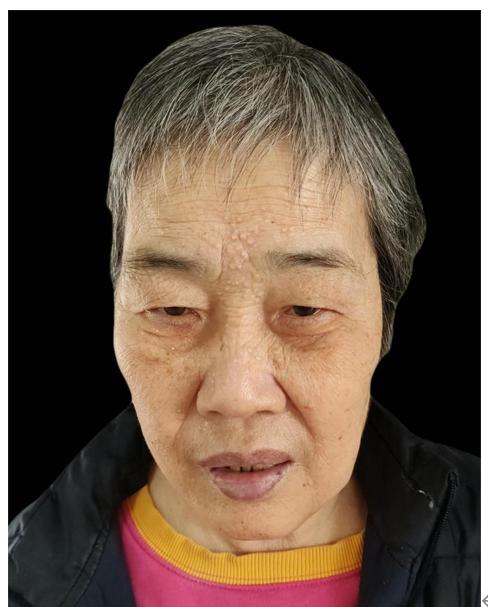 走失者照片 中山寻亲：五旬女子被救助，精神异常