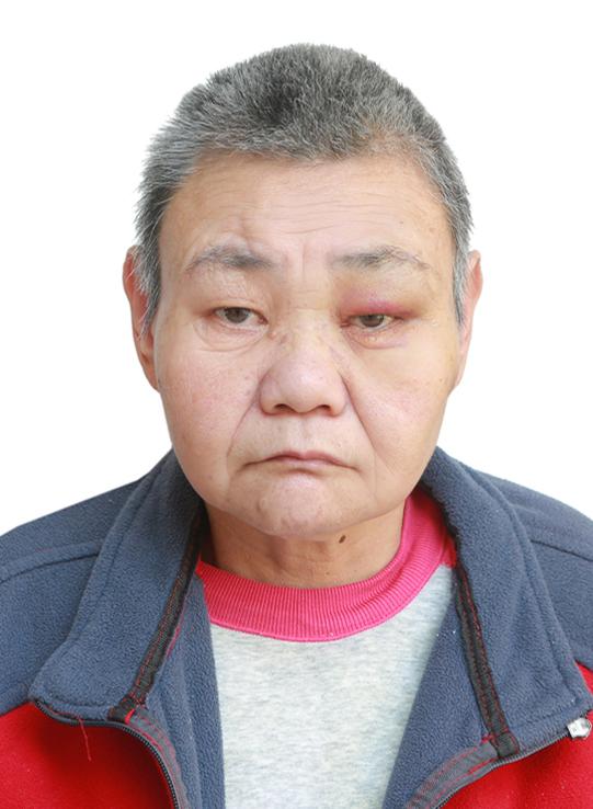 走失者照片 南昌寻亲：七旬老太被救助数月，自述...