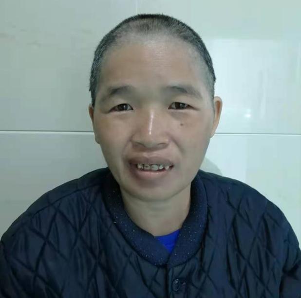 走失者照片 中山寻亲：中年女子被救助，精神异常