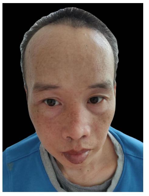 走失者照片 中山寻亲：中年男子被救助，自述叫陈...