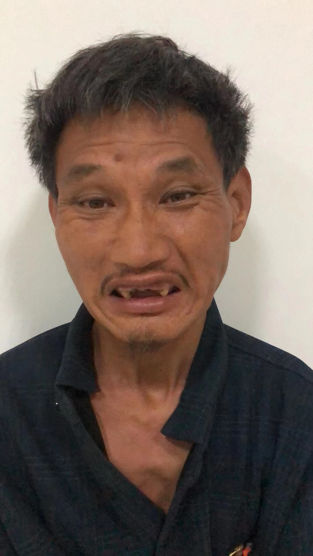 走失者照片 揭阳寻亲：五旬男子被救助，穿黑色暗...