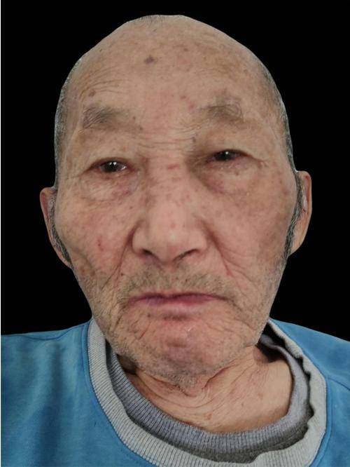 走失者照片 中山寻亲：九旬老人被救助，自述叫孙...