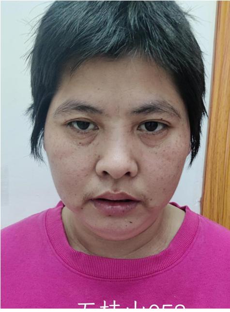 走失者照片 中山寻亲：青年女子被救助，精神异常