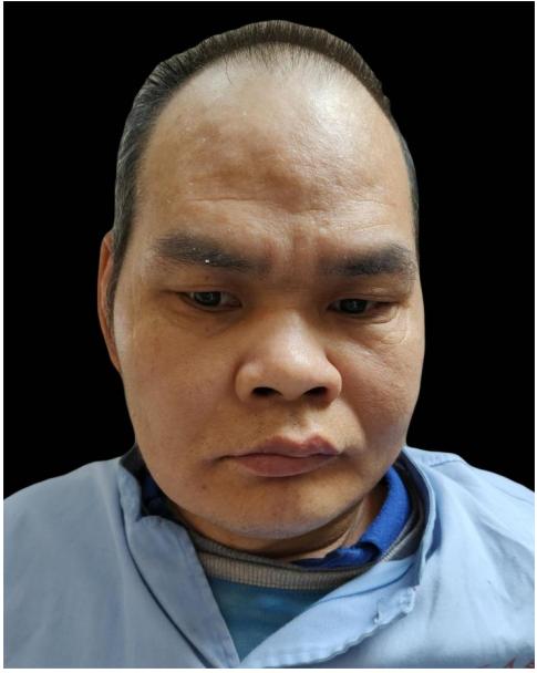 走失者照片 中山寻亲：中年男子被救助，精神异常