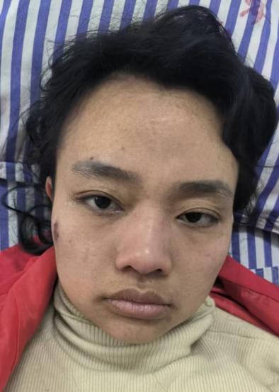 走失者照片 宜春寻亲：高安青年女子被救助，穿红...