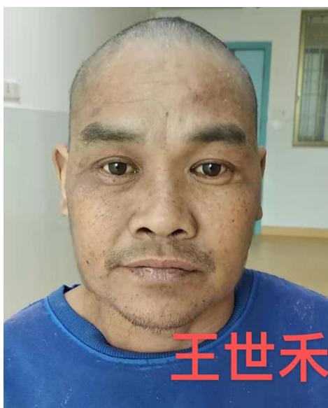 走失者照片 中山寻亲：青年男子被救助，自述叫王...