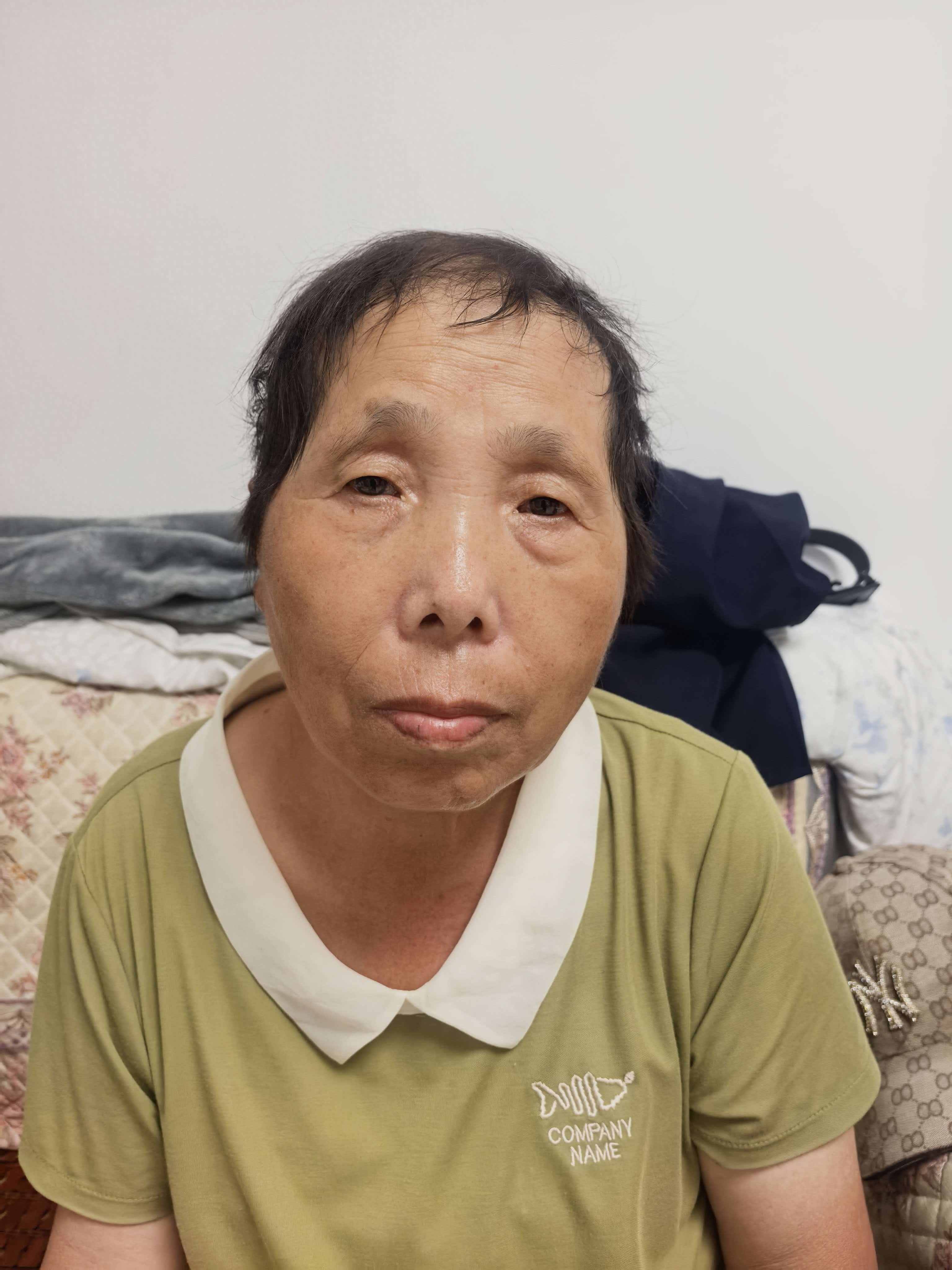 走失者照片 威海市寻人：六旬老太走失，穿白底黑...